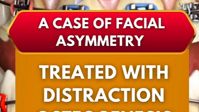 Special Case 1 Thumbnail